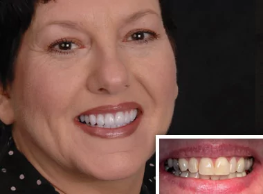 Woman who received aesthetic dentistry work from a cosmetic dentist in Oceanside.