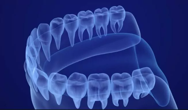 Digital x-rays used at Oceanside Dental Excellence assist in effective treatment.